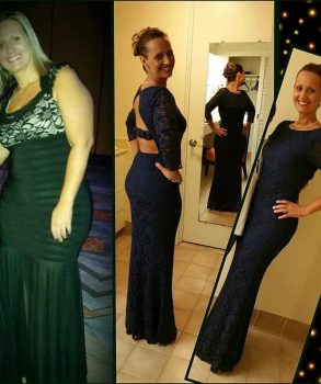 testimonial-2-before-after Carol M. Thomason Before & After